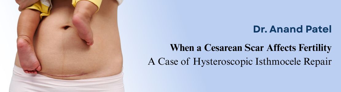When a Cesarean Scar Affects Fertility: A Case of Hysteroscopic Isthmocele Repair